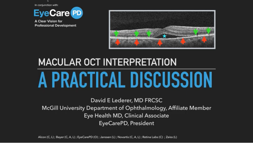 OCT Optical Coherence Tomography